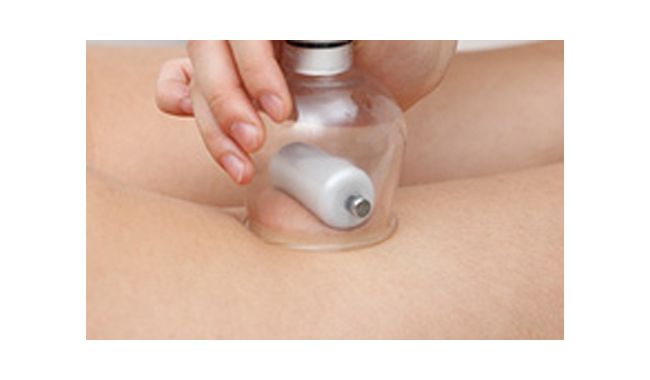 Geローラーカップ